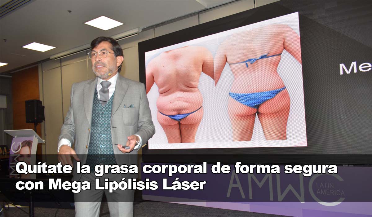 Eliminación segura y efectiva de grasa corporal con Mega Lipólisis Láser